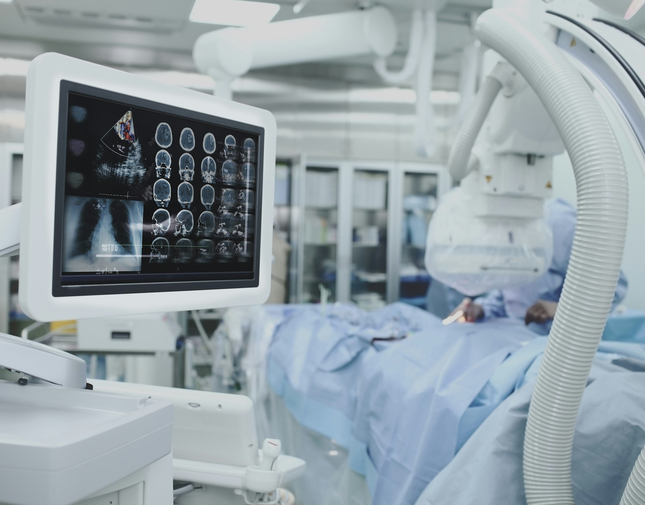 C Arm w monitor surgery Depositphotos 114786028 xl 2015