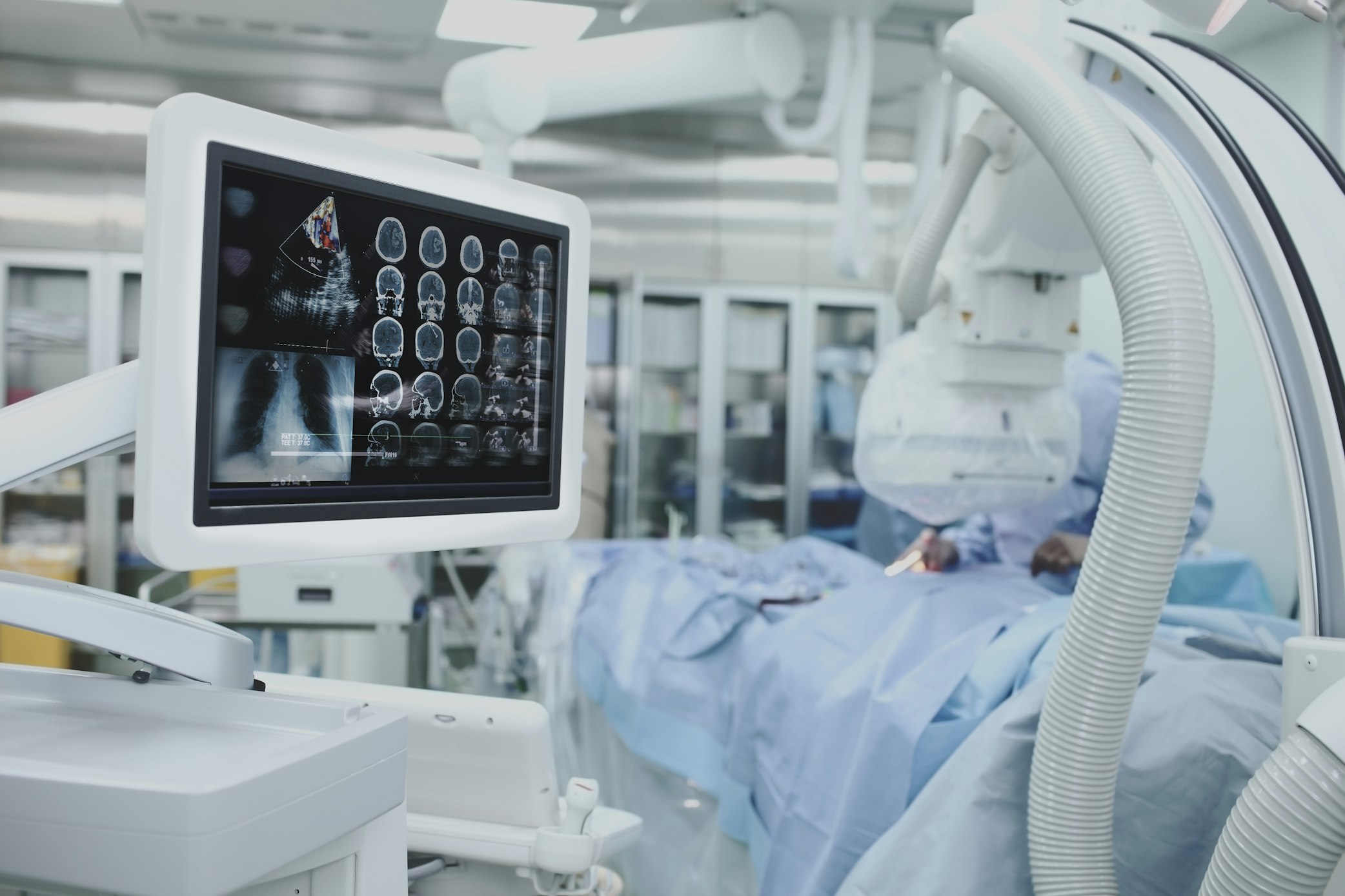 C Arm w monitor surgery Depositphotos 114786028 xl 2015